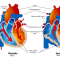 Neues Medikament von Cardiol kann Leben von COVID-19 Patienten mit Herzerkrankungen retten